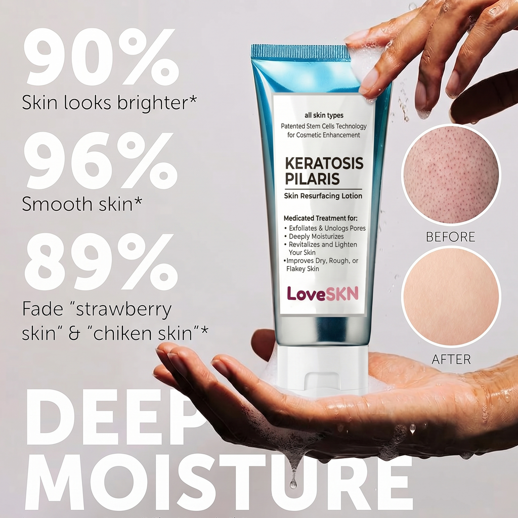 LoveSKN™ - Skin Resurfacing Lotion for Keratosis Pilaris