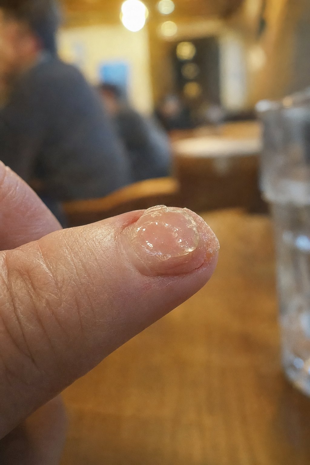 Jelly glue on a short nail